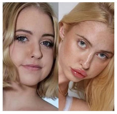 chloe cherry before fillers|chloe cherry lipstick.